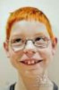 mepsp